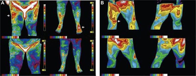 Improved wound healing through grounding