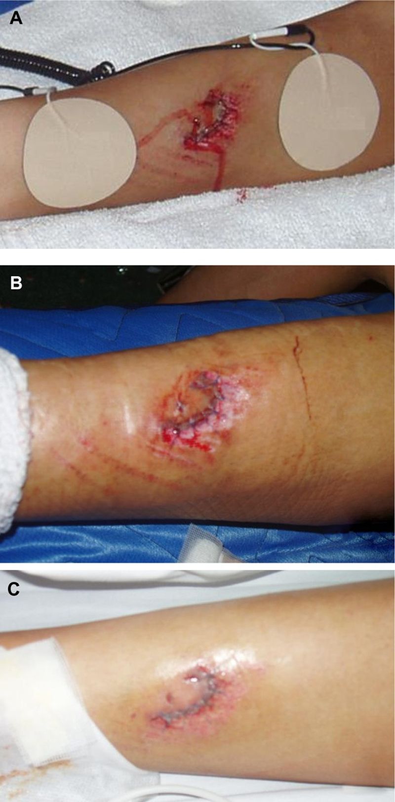 Research on grounding and inflammation